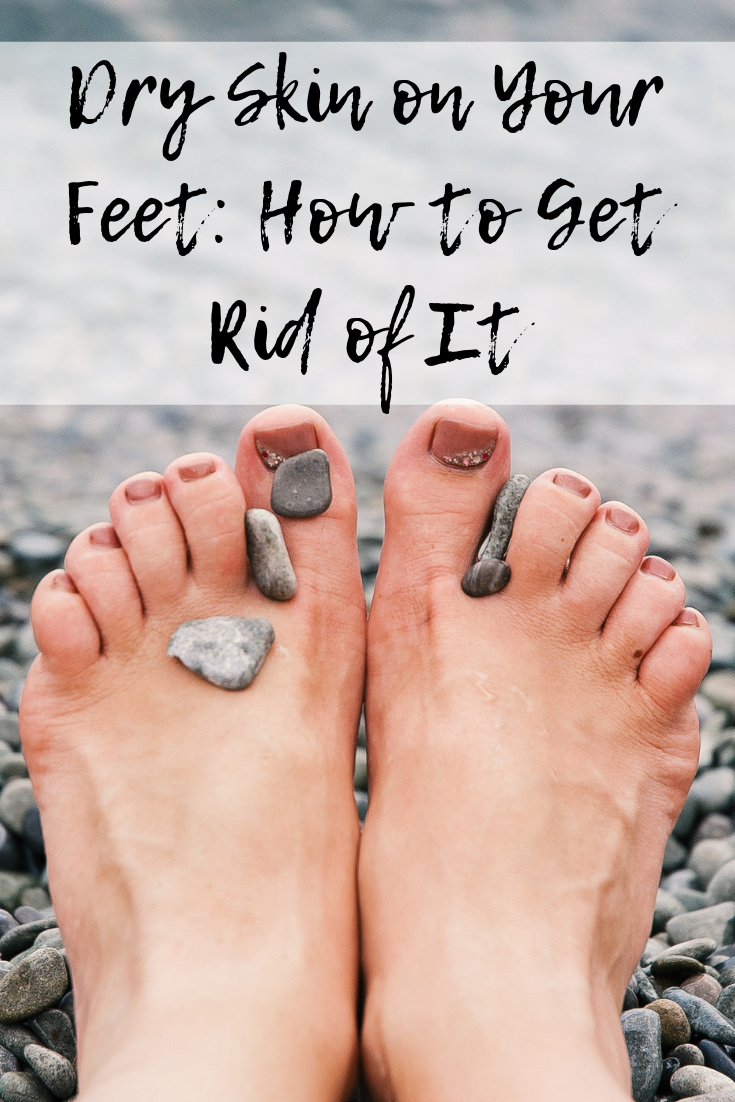 best way to get rid of dead skin on your feet