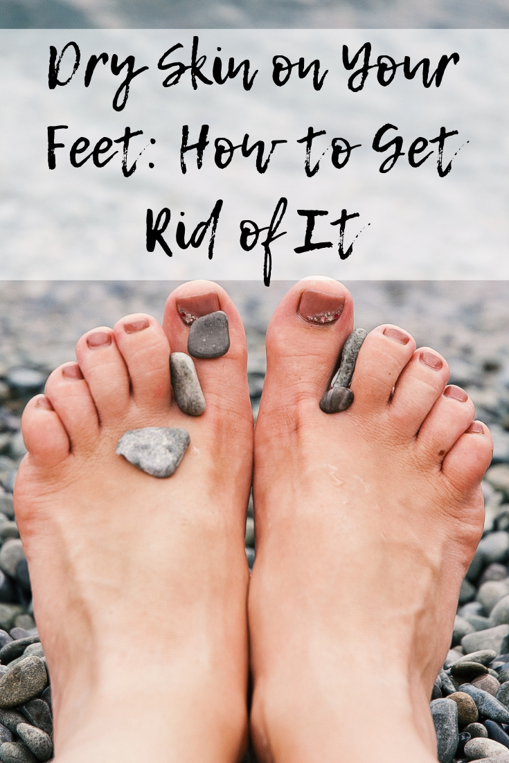 Dry Skin on Your Feet: How to Get Rid 